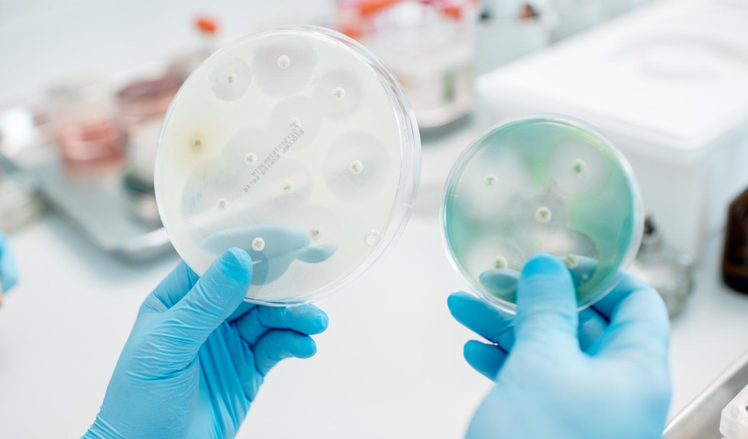 Hände halten Petrischalen im Labor